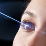 LASIK Surgery: Benefits, Risks, and Recovery Explained